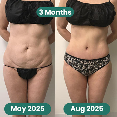 Skin Tightening Massager