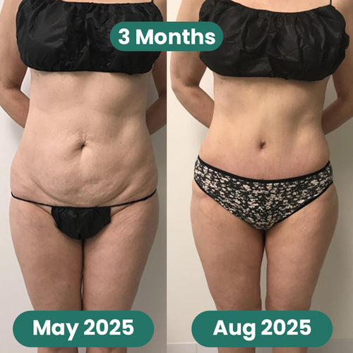 Skin Tightening Massager